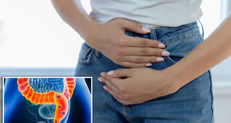 cresterea-cancerului-colorectal-la-tineri-ar-putea-fi-cauzata-de-ciuperci-–-new-york-post