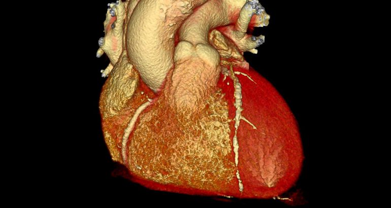 new-gene-editing-treatment-cuts-dangerous-cholesterol-in-small-study-–-the-new-york-times